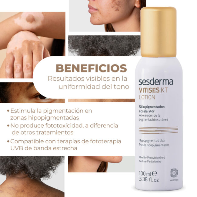 VITISES-KT-MIST-LOTION_1000-3.jpg