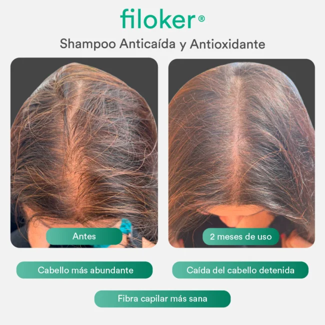 filoker_shampoo_antes-despues-01.webp filoker_shampoo_antes-despues-01.webp