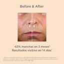thumbnail_web-latam_3371_th_melaclear_30ml_beforeandafter_5.jpg